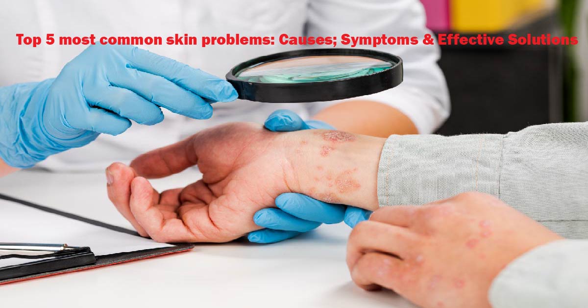 Derma Problem Top 5 most common skin problems: Causes, Symptoms & Solutions
