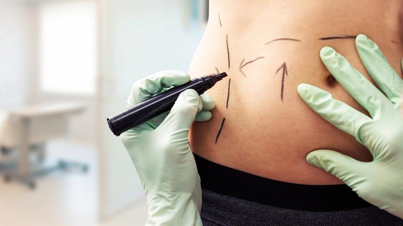 Liposuction Surgery in Bahrain