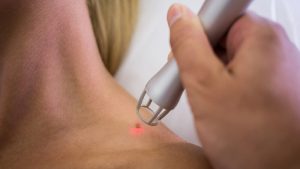 Laser treatment in Bahrain - German Medical Center