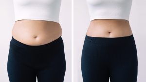 Dermatologist in Bahrain Get Safe VASER Abdominoplasty