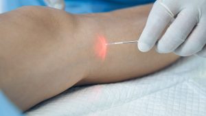 Laser treatment in Bahrain - German Medical Center