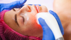 الليزر لعلاج التصبغات وتجديد البشرة في البحرين